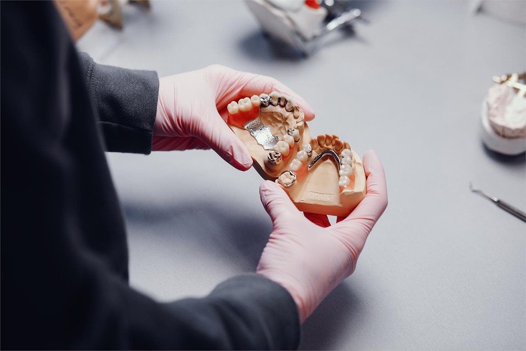 ¿Cómo cuidar mis implantes dentales? 