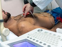 ¿Cómo se realiza un electrocardiograma?