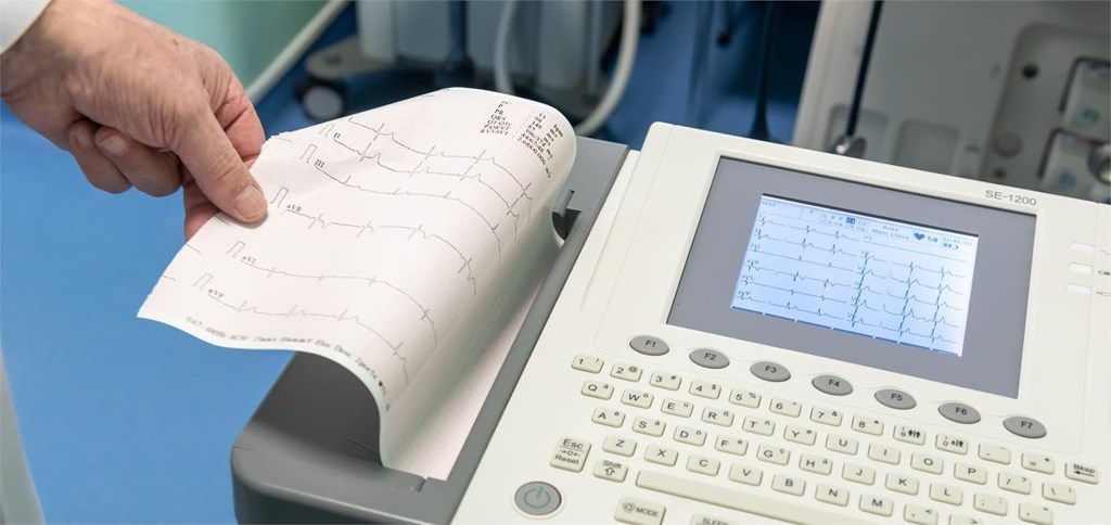 ¿En qué casos se necesita realizar un electrocardiograma y qué beneficios aporta?