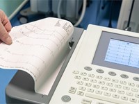 ¿En qué casos se necesita realizar un electrocardiograma y qué beneficios aporta?