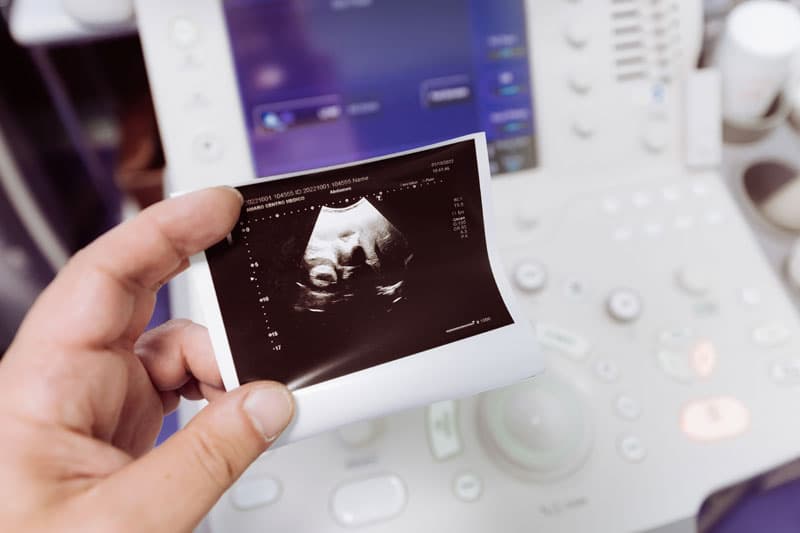 Prueba de embarazo - Centro Médico Amaro en Moaña