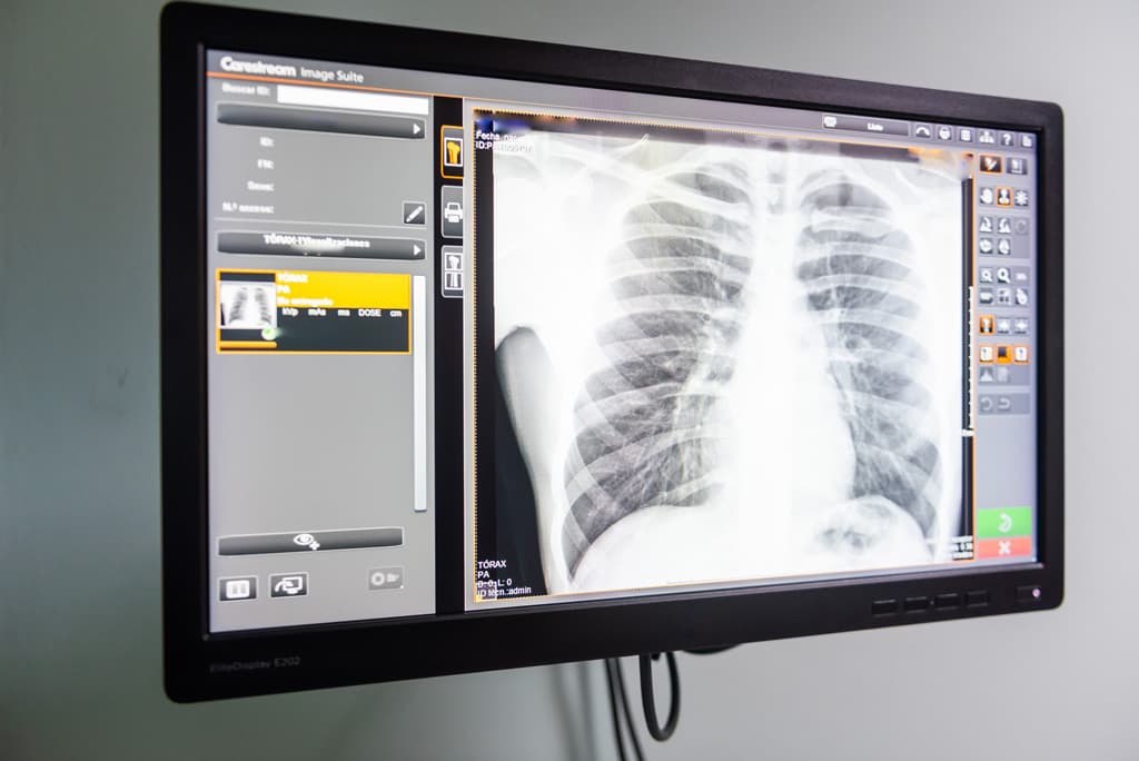 Radiografía digital - Centro Médico Amaro