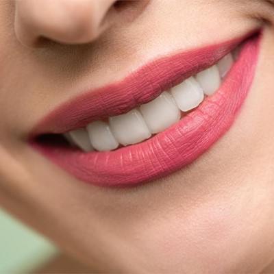 Periodontitis: causas, síntomas y tratamiento
